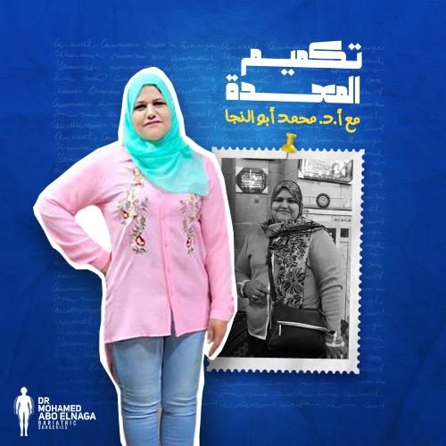 جدول النظام الغذائي بعد التكميم
